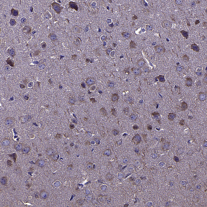 CAPRIN1 Mouse mAb