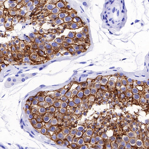 SLC7A5/LAT1 Recombinant Rabbit mAb (S-367-12)
