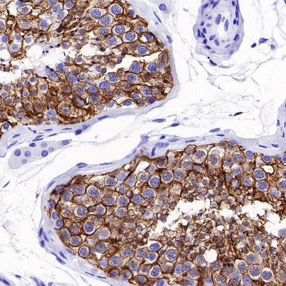 SLC7A5/LAT1 Recombinant Rabbit mAb (S-367-12)