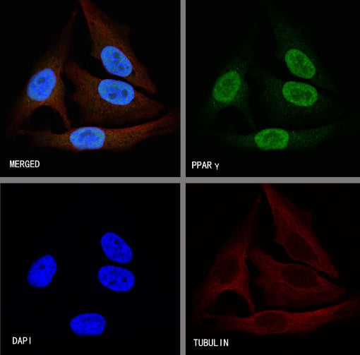 PPARγ Recombinant Rabbit mAb (SDT-556-108)