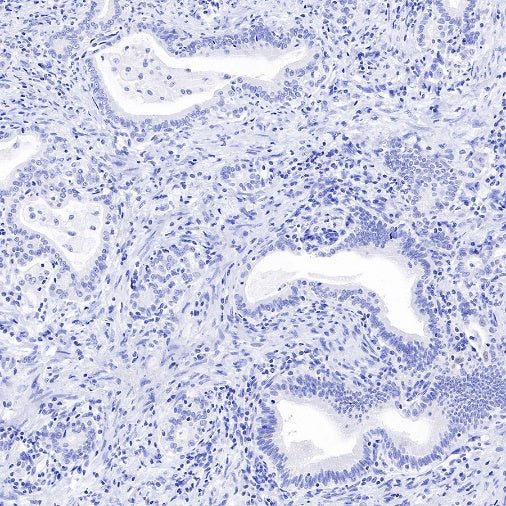 TRPS1 Recombinant Rabbit mAb (S-765-3)