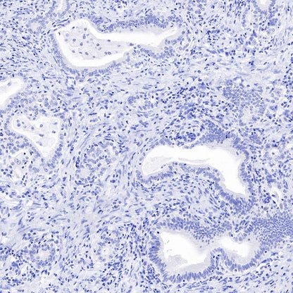 TRPS1 Recombinant Rabbit mAb (S-765-3)