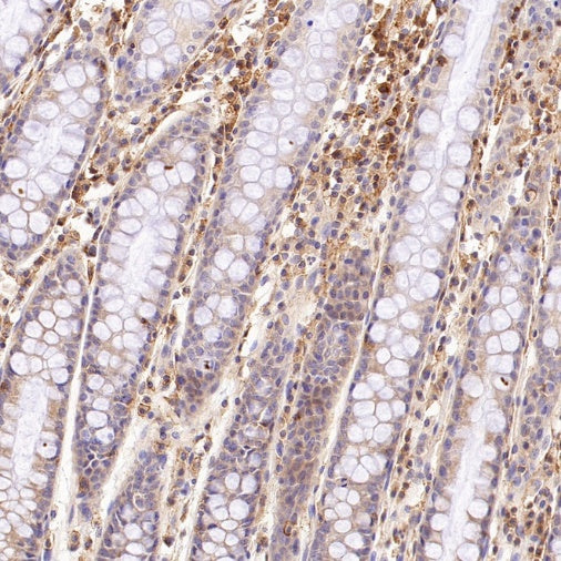 CD100/Semaphorin-4D Recombinant Rabbit mAb (S-3651-16)