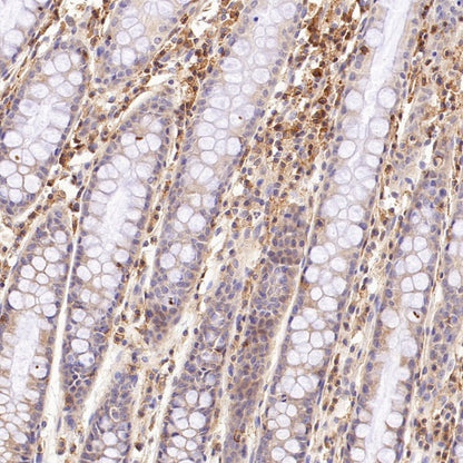 CD100/Semaphorin-4D Recombinant Rabbit mAb (S-3651-16)