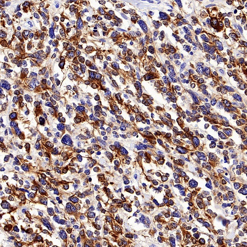 MAP2 Recombinant Rabbit mAb (SDT-2060-28)