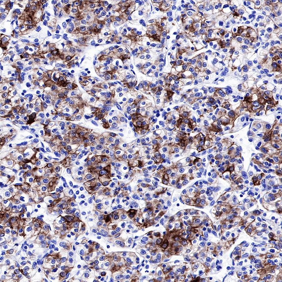 CK-LMW Recombinant Rabbit mAb (SDT-P003)