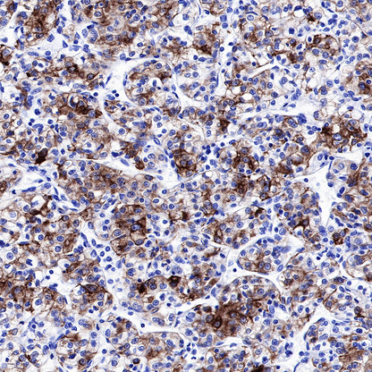 CK-LMW Recombinant Rabbit mAb (SDT-P003)