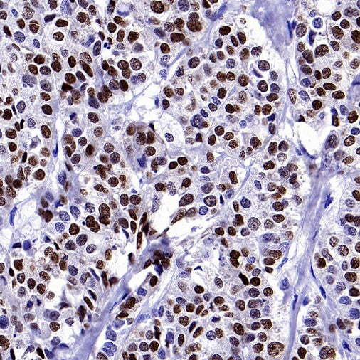 ER alpha Recombinant Rabbit mAb (SDT-2950-36)