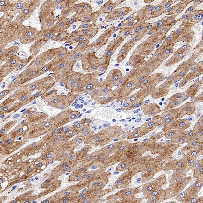 ASGR1 Rabbit Polyclonal Antibody