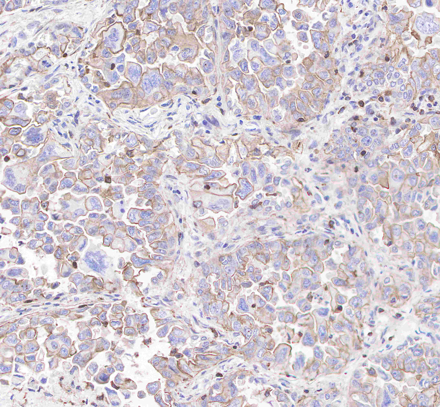CD206 Recombinant Rabbit mAb(SDT-022-2)
