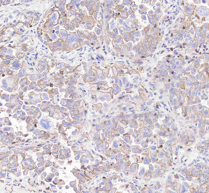 CD206 Recombinant Rabbit mAb(SDT-022-2)