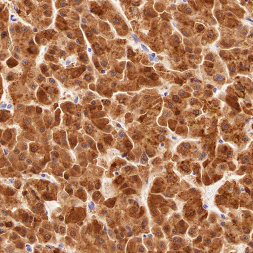 Glutamine Synthetase (GS) Recombinant Rabbit mAb (SDT-549-25)