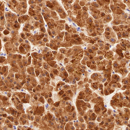 Glutamine Synthetase (GS) Recombinant Rabbit mAb (SDT-549-25)