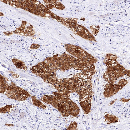 14-3-3 sigma Recombinant Rabbit mAb (S-2017-59)