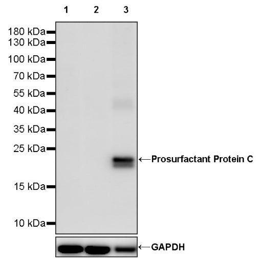 Prosurfactant Protein C Recombinant Rabbit mAb (S-1773-6)