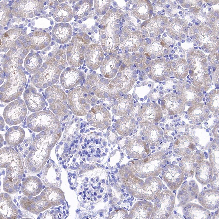 RPS14 Rabbit Polyclonal Antibody