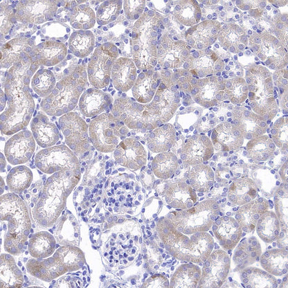 RPS14 Rabbit Polyclonal Antibody