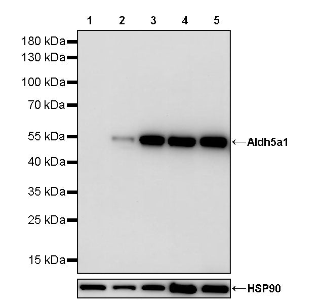 Aldh5a1 Recombinant Rabbit mAb (S-4135-76)