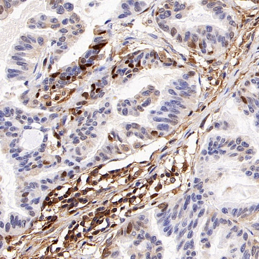 FTH1 Recombinant Rabbit mAb (S-1372-136)