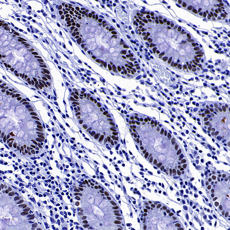 FOXA1 Recombinant Rabbit mAb (S-4339)