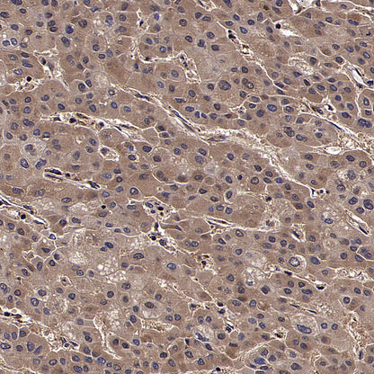 CYTB Recombinant Rabbit mAb (S-3877-15)