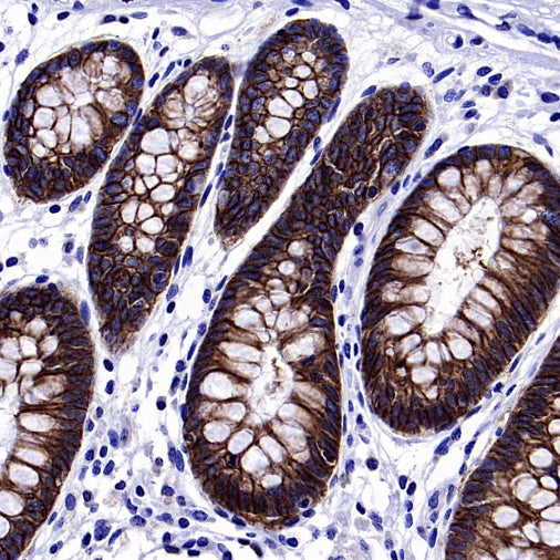 S-RMab® EpCAM Recombinant Rabbit mAb (SDT-078-128)