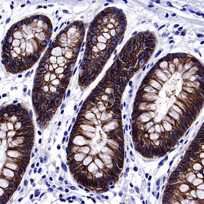 S-RMab® EpCAM Recombinant Rabbit mAb (SDT-078-128)
