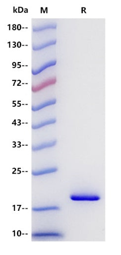 IL-1 beta/IL-1F2 His Tag Protein, Mouse