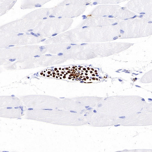 Neurofilament L Recombinant Rabbit mAb (S-635-214)
