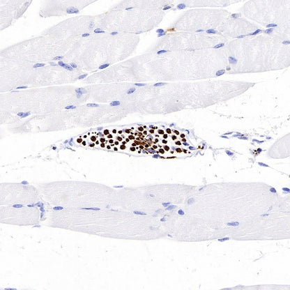 Neurofilament L Recombinant Rabbit mAb (S-635-214)