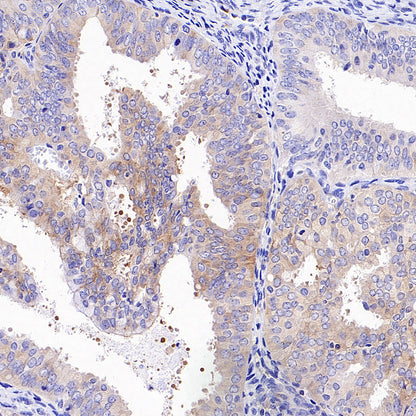 STK39 Recombinant Rabbit mAb (S-3630-15)