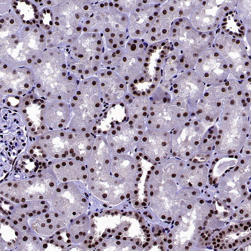 U2AF1 Recombinant Rabbit mAb (S-2384)