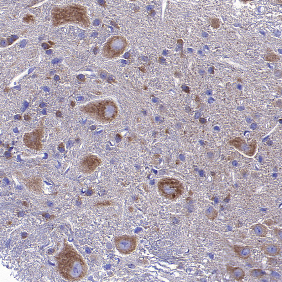 STK39 Recombinant Rabbit mAb (S-3630-15)