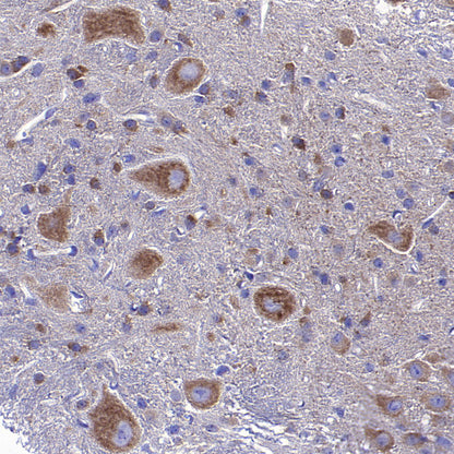 STK39 Recombinant Rabbit mAb (S-3630-15)