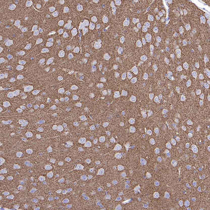 GAP43 Rabbit Polyclonal Antibody-Neuronal Marker