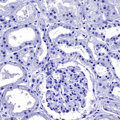 Uteroglobin Recombinant Rabbit mAb (SDT-2736-46)