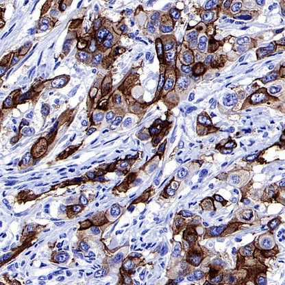 S-RMab® MUC1/EMA Recombinant Rabbit mAb (SDT-776-49)