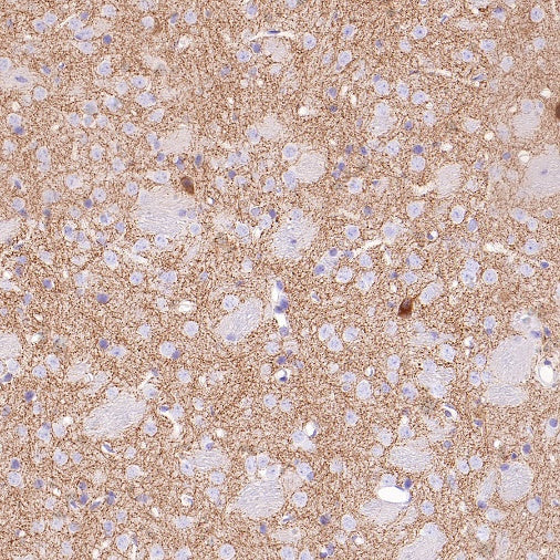 VGLUT3 Recombinant Rabbit mAb (S-2430-26)