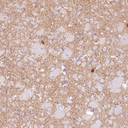 VGLUT3 Recombinant Rabbit mAb (S-2430-26)