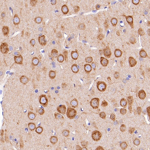 SERCA2 ATPase Recombinant Rabbit mAb (S-5956)