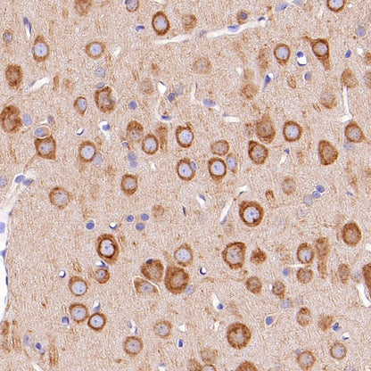 SERCA2 ATPase Recombinant Rabbit mAb (S-5956)