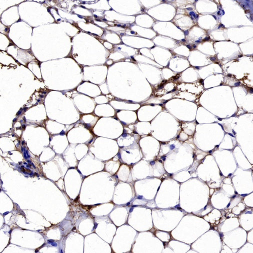 UCP1 Recombinant Rabbit mAb (SDT-2275-37)