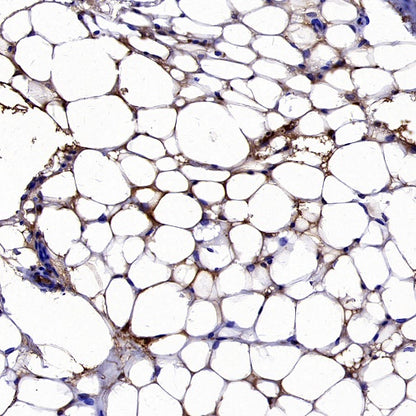 UCP1 Recombinant Rabbit mAb (SDT-2275-37)