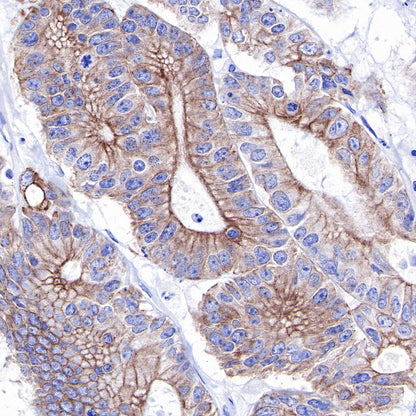 Keratin 18 Recombinant Rabbit mAb (SDT-R081)