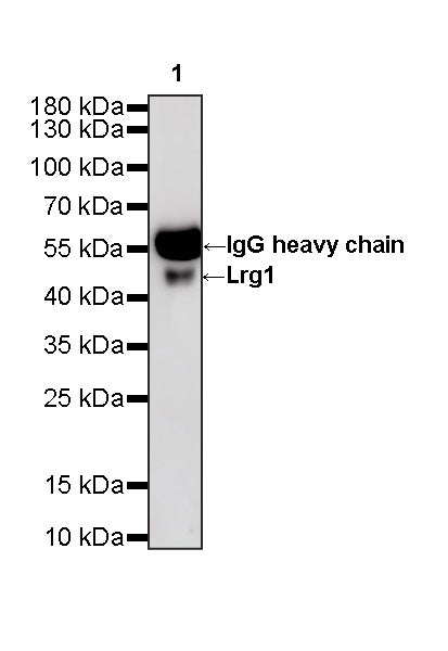 Lrg1 Recombinant Rabbit mAb (S-4084-27)