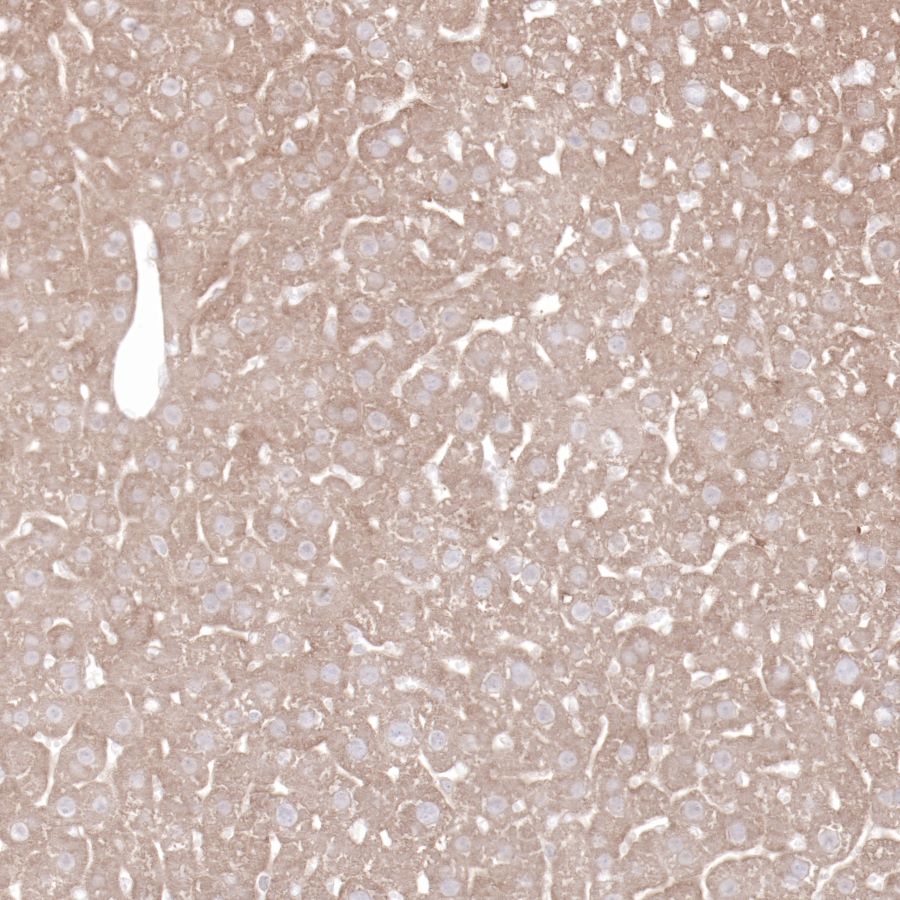 Hsp90 beta Recombinant Rabbit mAb (SDT-R033)