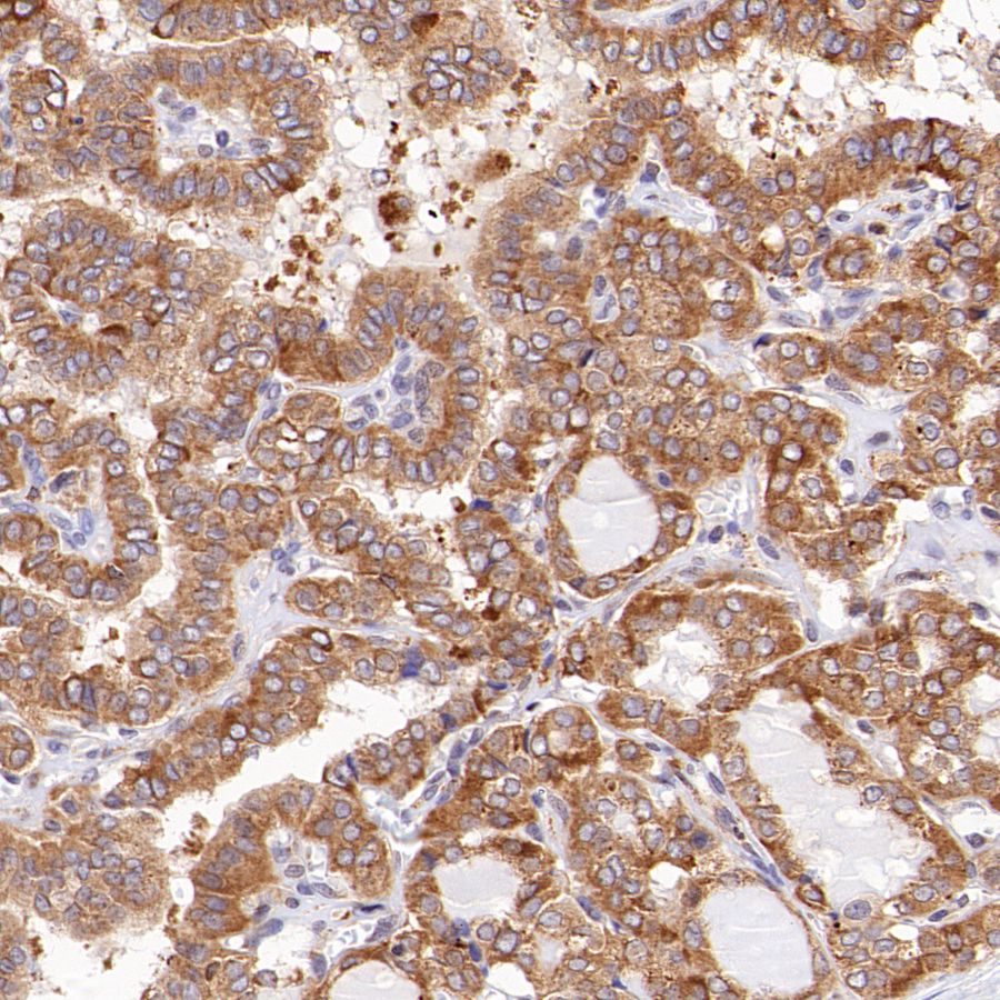 PDIA3 Rabbit Polyclonal Antibody