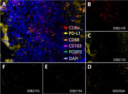 PD-L1, Regulatory T cell, Cytotoxic T cell and Macrophage Marker (PD-L1, FOXP3, CD8α, CD68, CD163) Antibody Panel
