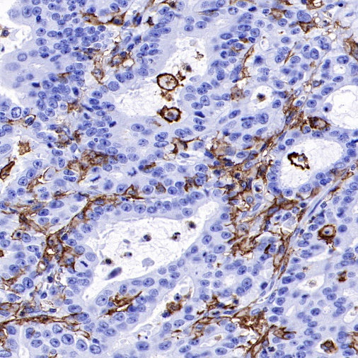 LAIR1 Recombinant Rabbit mAb (S-285-2)
