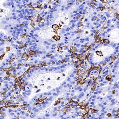 LAIR1 Recombinant Rabbit mAb (S-285-2)